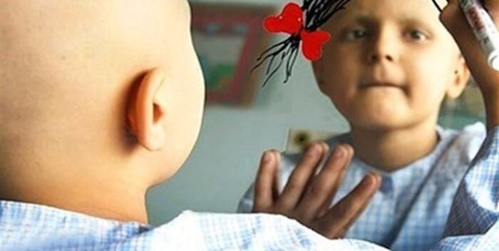 خبر خوب| ۴۴ کودک سرطانی در رشت با موفقیت درمان شدند